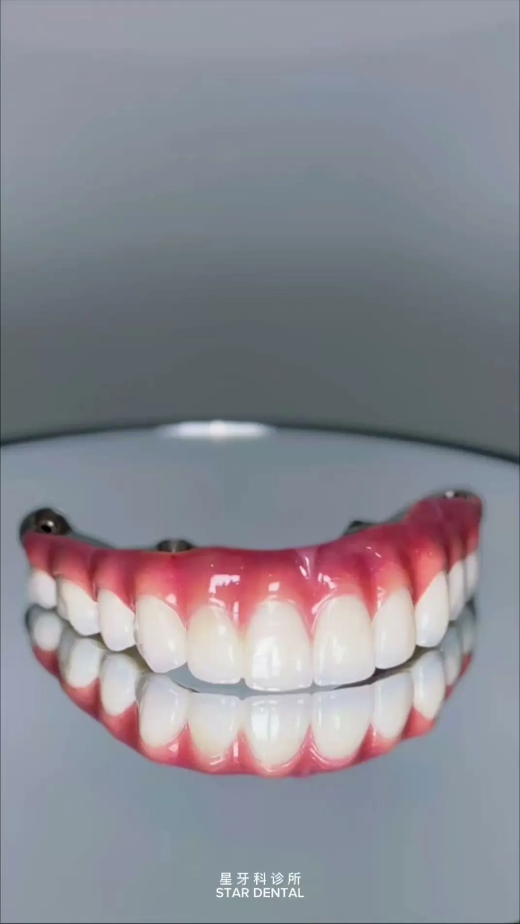 Star Dental Clinic Bukit Mertajam - Implant & Braces Centre photo 4