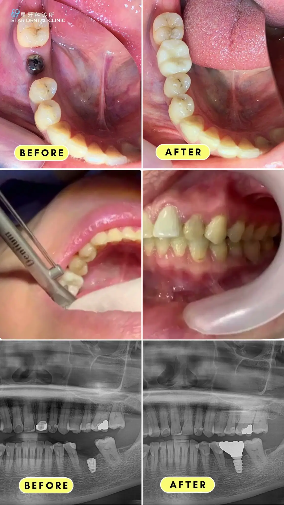 Star Dental Clinic Bukit Mertajam - Implant & Braces Centre photo 5