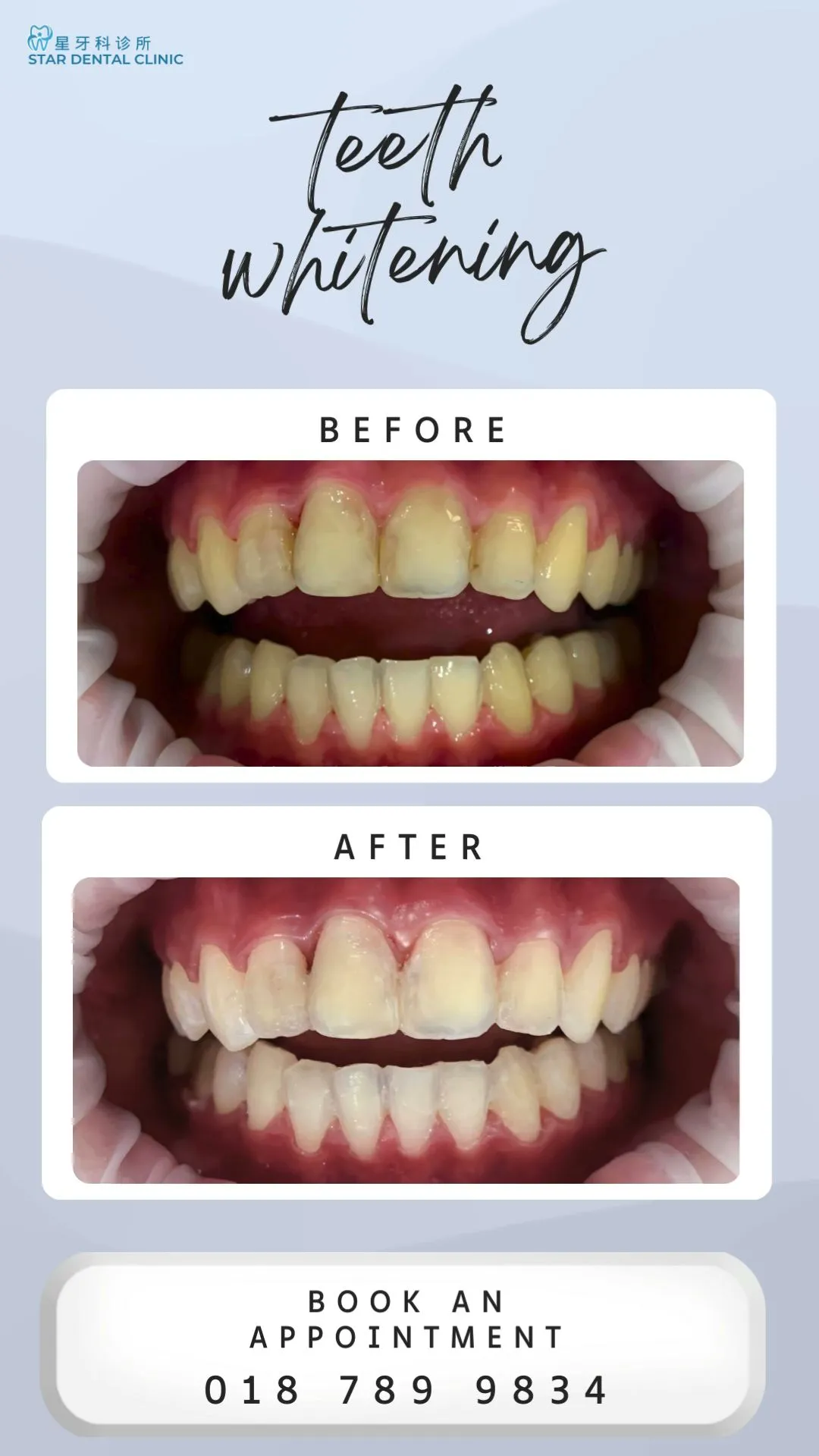 Star Dental Clinic Bukit Mertajam - Implant & Braces Centre photo 6